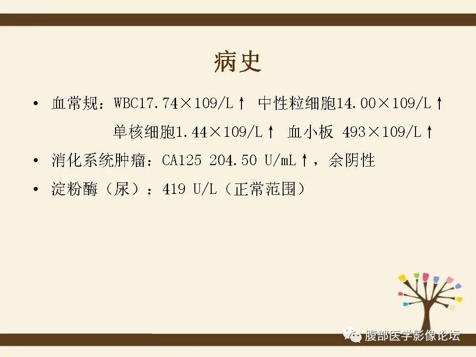 影像PPT - 【病例】胰腺平滑肌肉瘤1例CT影像诊断-4 影像PPT - 【病例】胰腺平滑肌肉瘤1例CT影像诊断-4