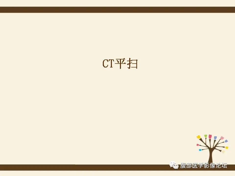 影像PPT - 【病例】胰腺平滑肌肉瘤1例CT影像诊断-5 影像PPT - 【病例】胰腺平滑肌肉瘤1例CT影像诊断-5