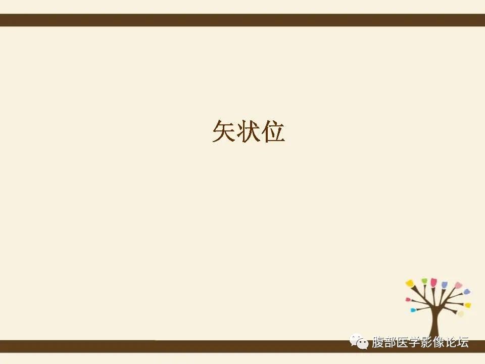 影像PPT - 【病例】胰腺平滑肌肉瘤1例CT影像诊断-16 影像PPT - 【病例】胰腺平滑肌肉瘤1例CT影像诊断-16