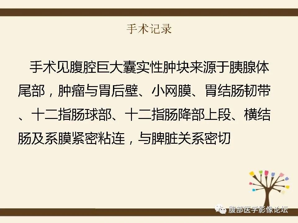 影像PPT - 【病例】胰腺平滑肌肉瘤1例CT影像诊断-18 影像PPT - 【病例】胰腺平滑肌肉瘤1例CT影像诊断-18