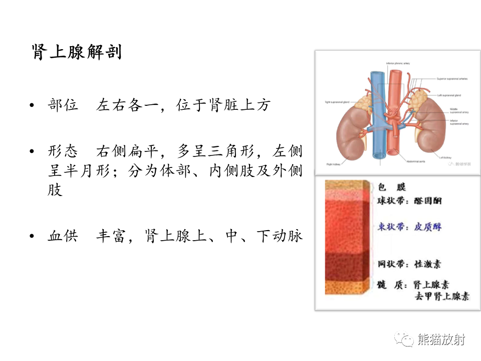 影像PPT - 【病例】肾上腺占位两例—腺瘤VS嗜铬细胞瘤CT及MR-19