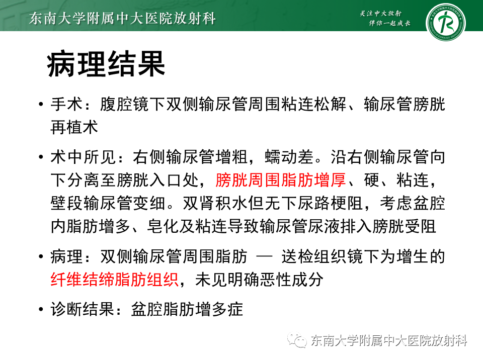 影像PPT - 【病例】盆腔脂肪增多症1例CT影像-3