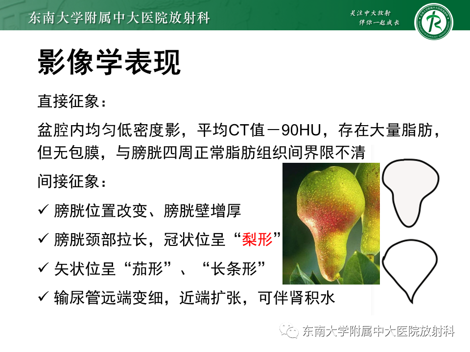 影像PPT - 【病例】盆腔脂肪增多症1例CT影像-9