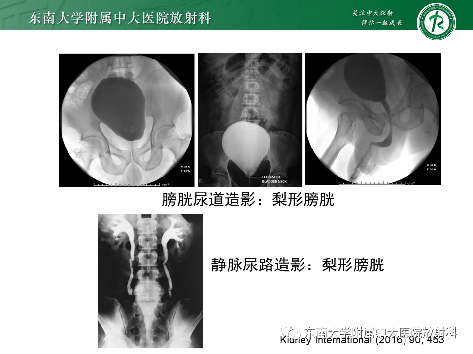 影像PPT - 【病例】盆腔脂肪增多症1例CT影像-10
