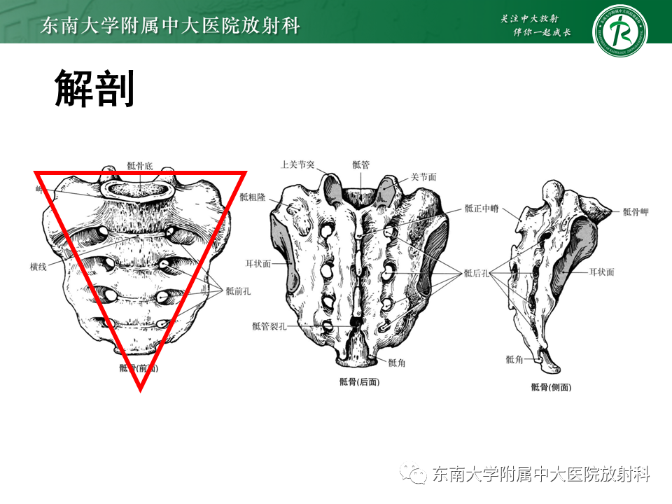 影像PPT - 【病例】骶骨衰竭骨折（不全骨折）1例CT及MR影像-4