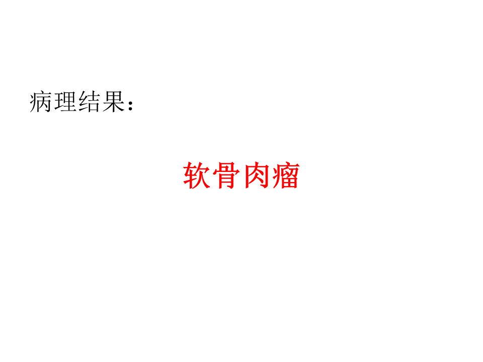 影像PPT - 【病例】软骨肉瘤2例X线CT及MR影像-28