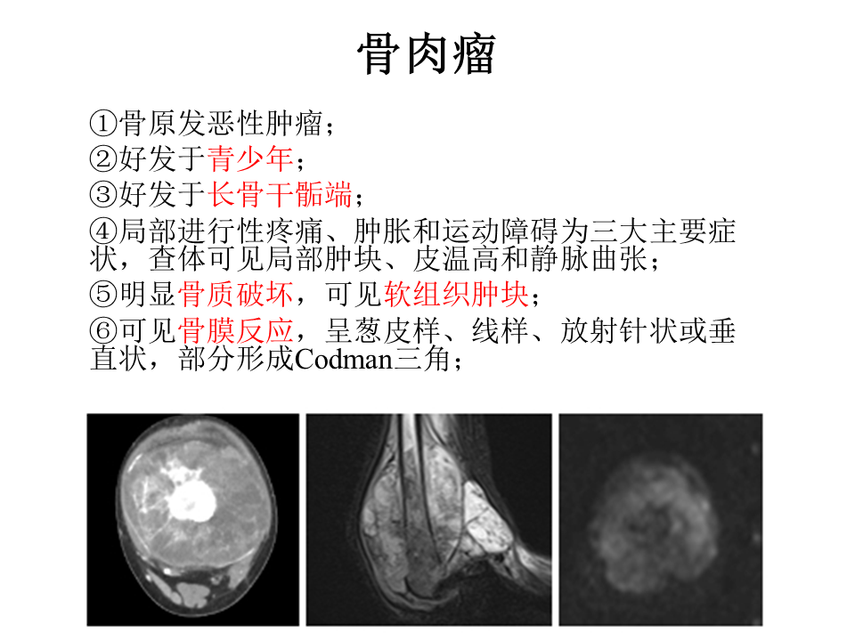 影像PPT - 【病例】软骨肉瘤2例X线CT及MR影像-35