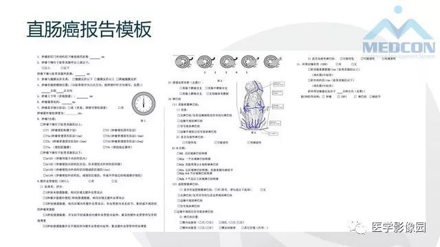 影像PPT - 【PPT】直肠癌MR影像报告书写-3