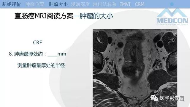 影像PPT - 【PPT】直肠癌MR影像报告书写-13