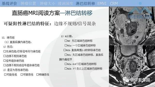 影像PPT - 【PPT】直肠癌MR影像报告书写-19