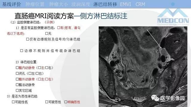 影像PPT - 【PPT】直肠癌MR影像报告书写-20