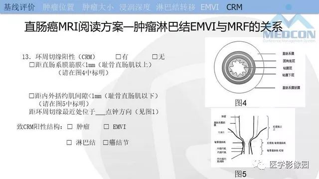 影像PPT - 【PPT】直肠癌MR影像报告书写-24