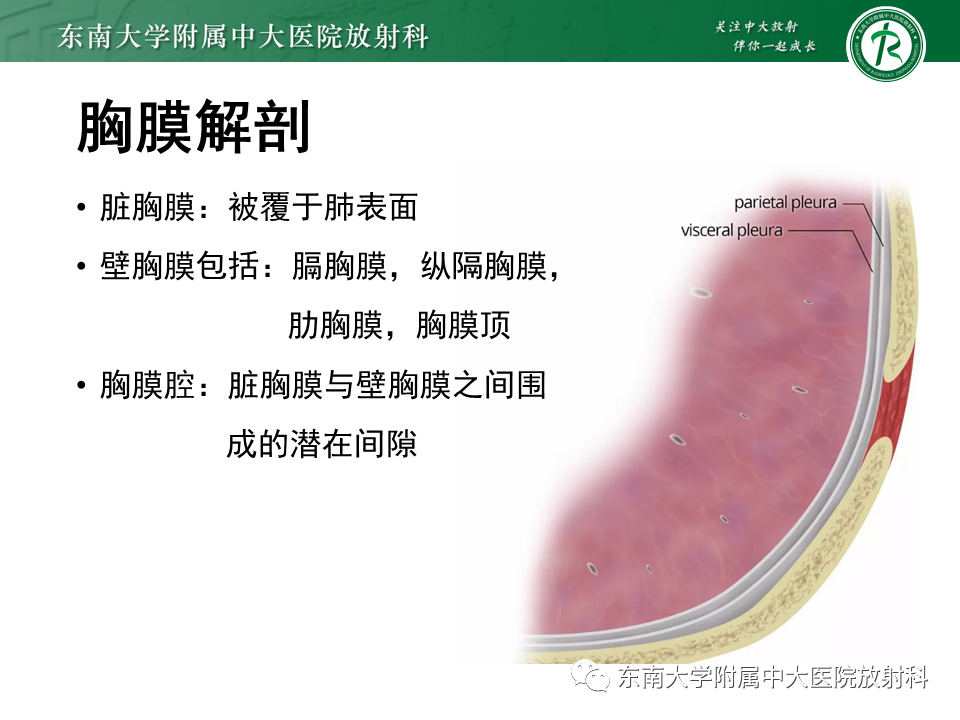 影像PPT - 【病例】胸膜孤立性纤维瘤1例CT影像-5