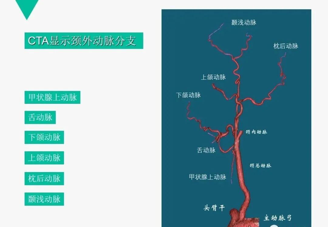 影像PPT - 【PPT】头颈血管解剖与分段—CTA重组图像示例-8