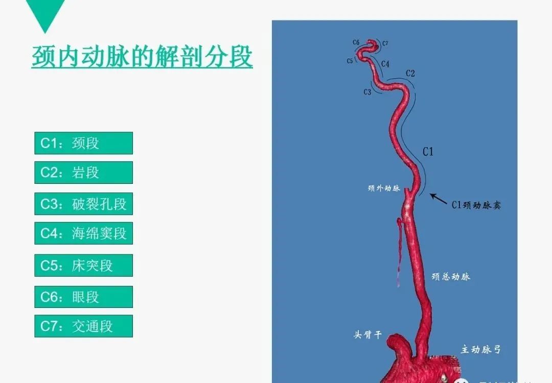 影像PPT - 【PPT】头颈血管解剖与分段—CTA重组图像示例-14