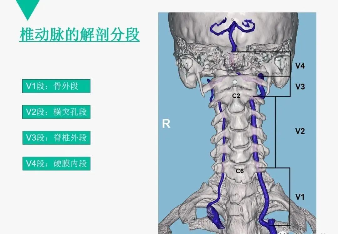 影像PPT - 【PPT】头颈血管解剖与分段—CTA重组图像示例-15