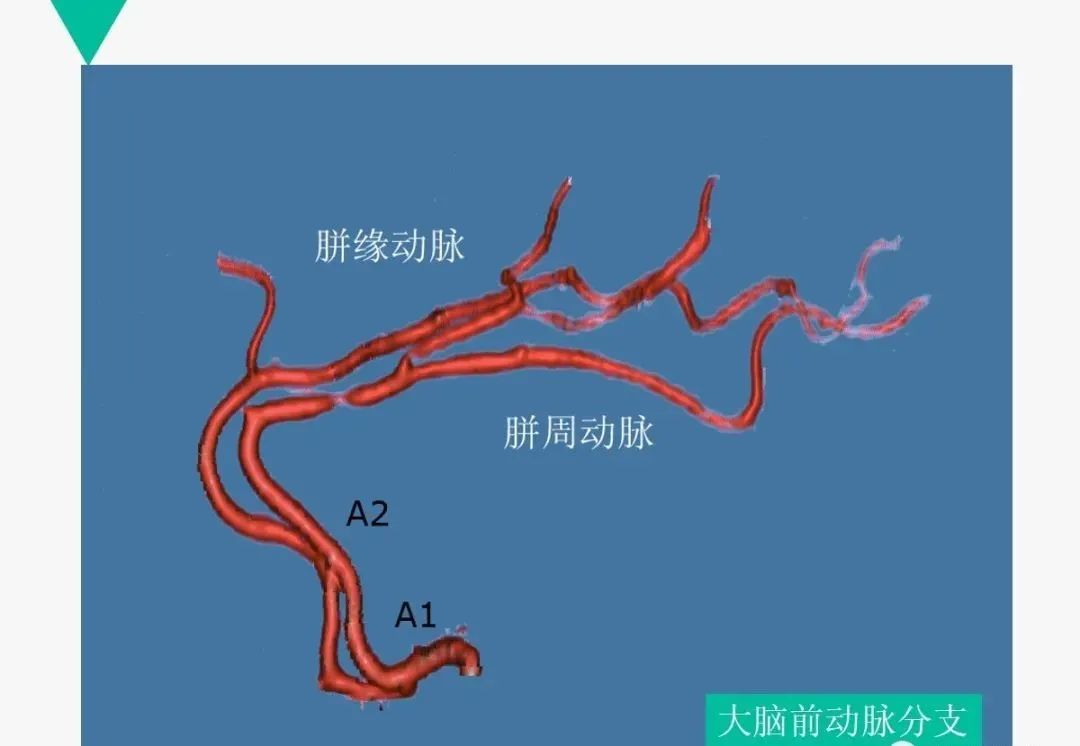 影像PPT - 【PPT】头颈血管解剖与分段—CTA重组图像示例-19