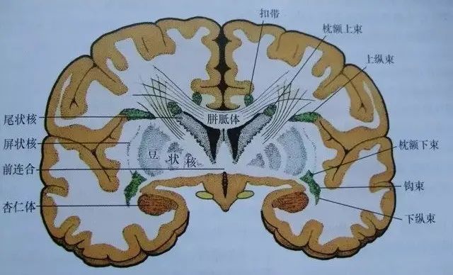影像PPT - 放射冠与半卵圆中心的区别-5 影像PPT - 放射冠与半卵圆中心的区别-5