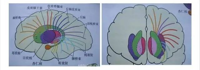 影像PPT - 放射冠与半卵圆中心的区别-8 影像PPT - 放射冠与半卵圆中心的区别-8