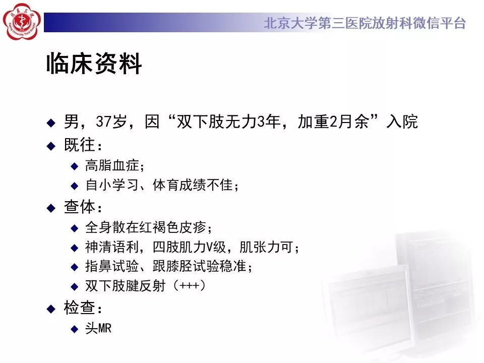 影像PPT - 【PPT】肾上腺脑白质营养不良（ALD）影像诊断-1