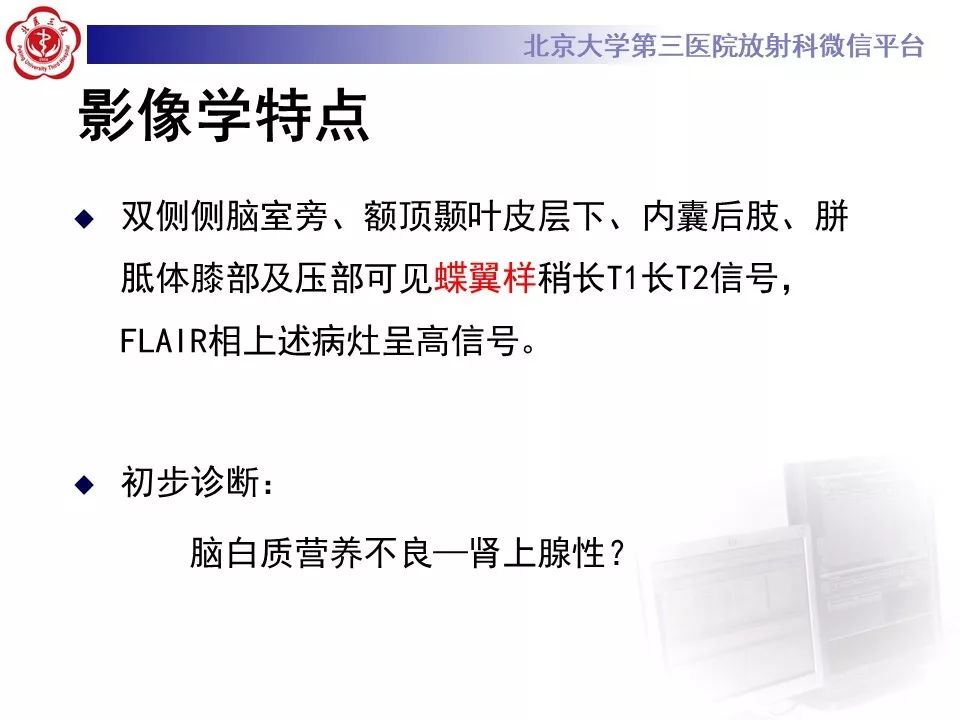 影像PPT - 【PPT】肾上腺脑白质营养不良（ALD）影像诊断-10