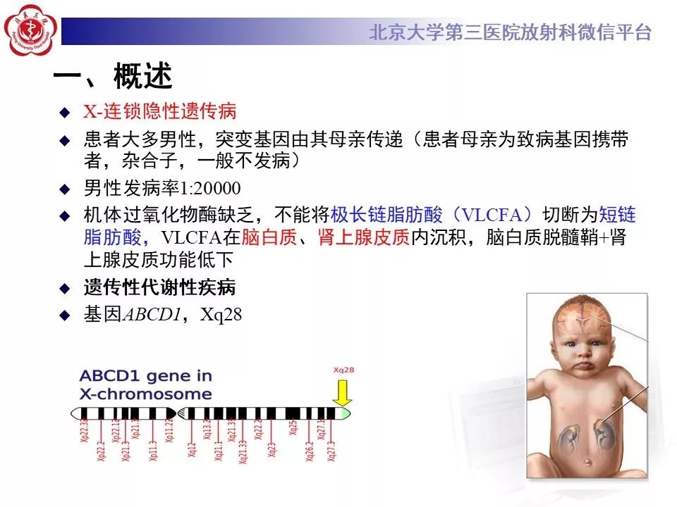 影像PPT - 【PPT】肾上腺脑白质营养不良（ALD）影像诊断-12