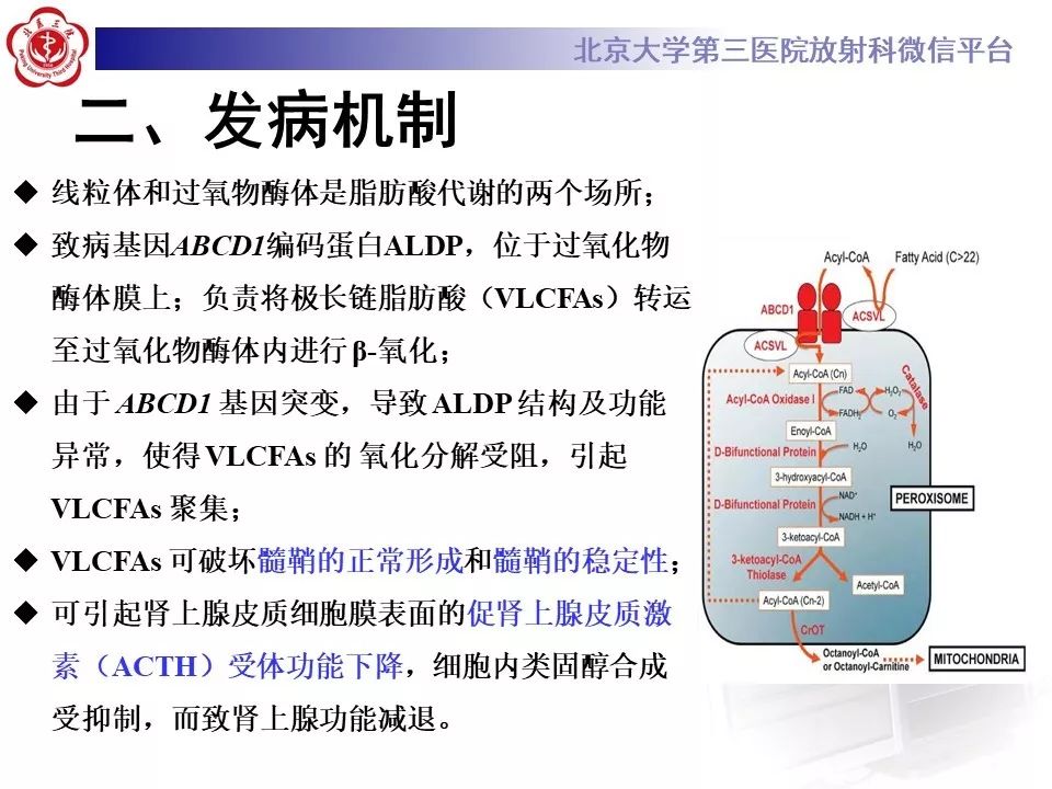影像PPT - 【PPT】肾上腺脑白质营养不良（ALD）影像诊断-13