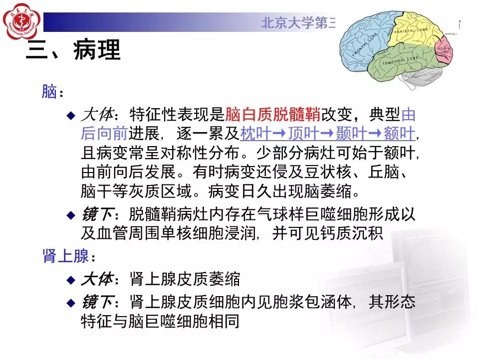 影像PPT - 【PPT】肾上腺脑白质营养不良（ALD）影像诊断-14