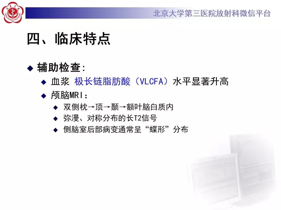 影像PPT - 【PPT】肾上腺脑白质营养不良（ALD）影像诊断-19
