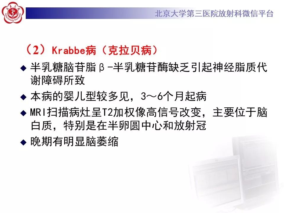 影像PPT - 【PPT】肾上腺脑白质营养不良（ALD）影像诊断-27
