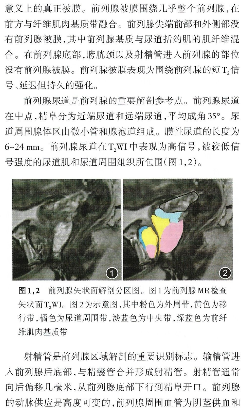 影像PPT - 前列腺MRI解剖分区-5 影像PPT - 前列腺MRI解剖分区-5