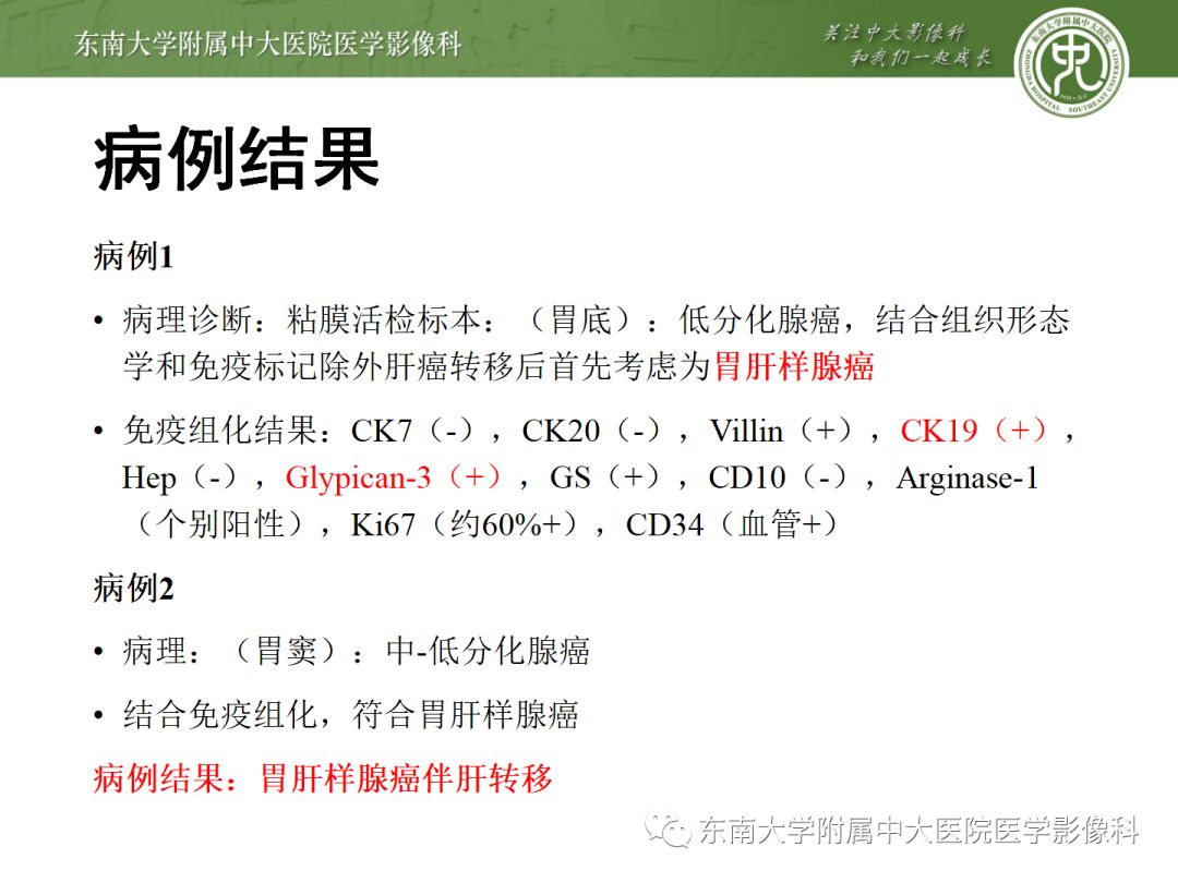 影像PPT - 【病例】胃肝样腺癌伴肝转移2例影像诊断-7