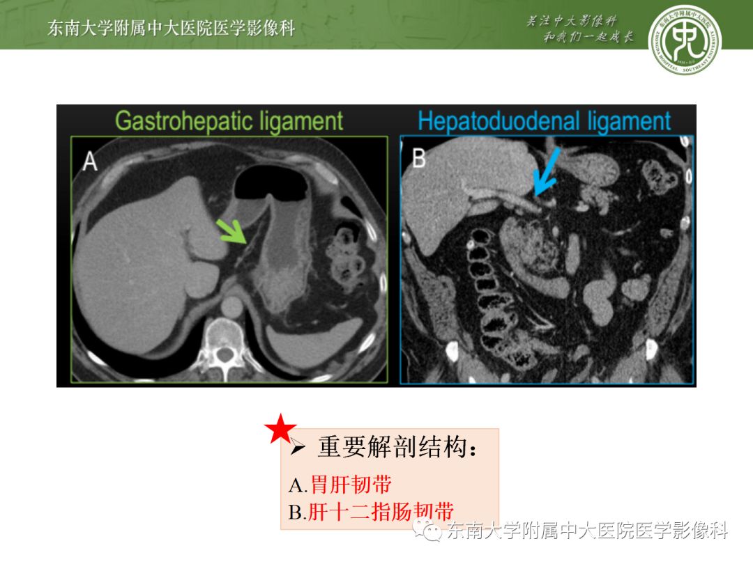 影像PPT - 【病例】胃肝样腺癌伴肝转移2例影像诊断-10