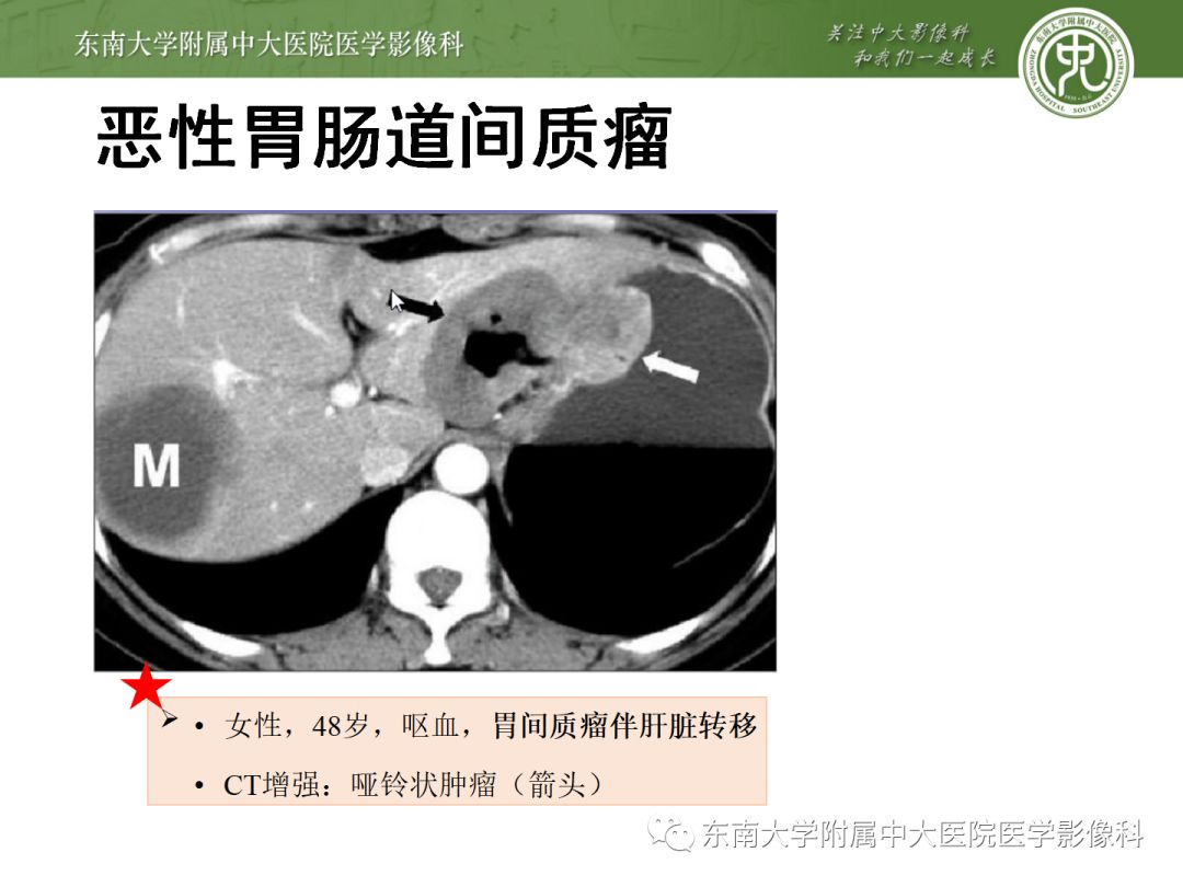影像PPT - 【病例】胃肝样腺癌伴肝转移2例影像诊断-25