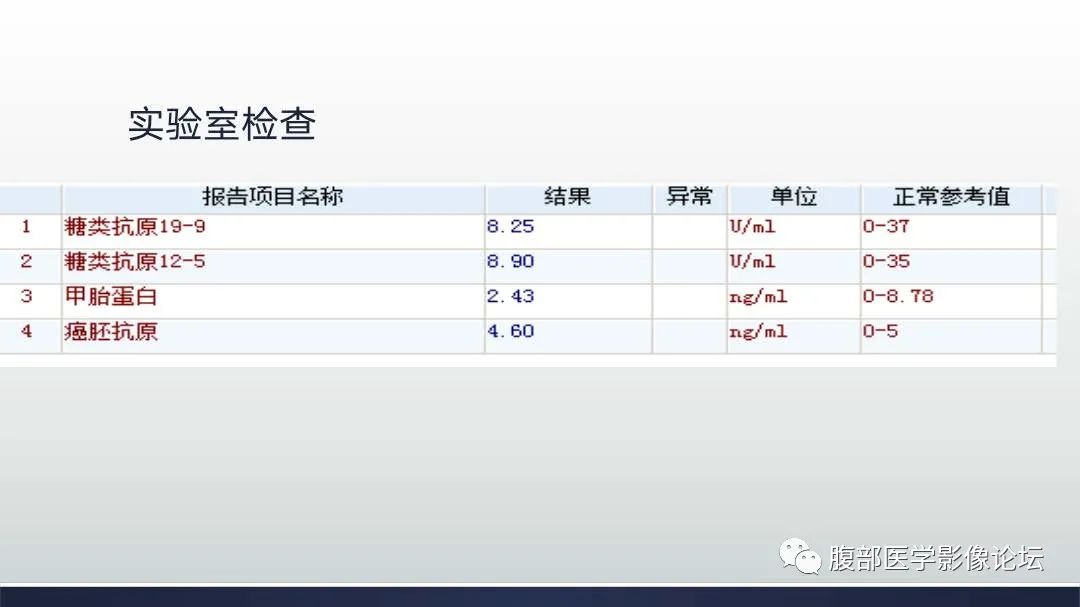 影像PPT - 【病例】肝细胞肝癌2例CT及MR影像-4 影像PPT - 【病例】肝细胞肝癌2例CT及MR影像-4