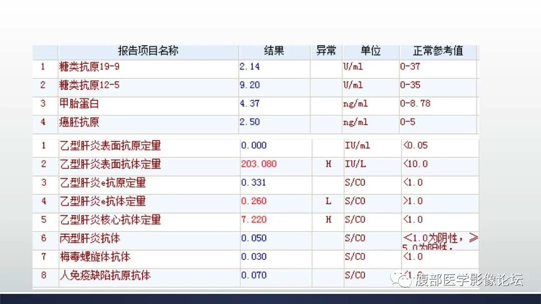 影像PPT - 【病例】肝细胞肝癌2例CT及MR影像-15 影像PPT - 【病例】肝细胞肝癌2例CT及MR影像-15