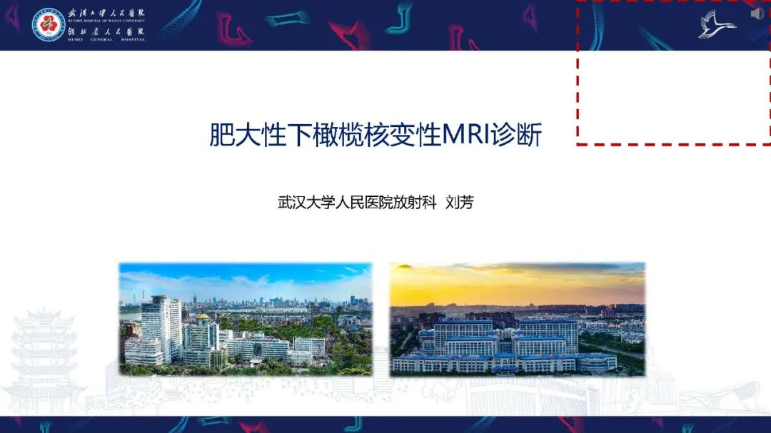 影像PPT - 【PPT】肥大性下橄榄核变性MRI诊断-1