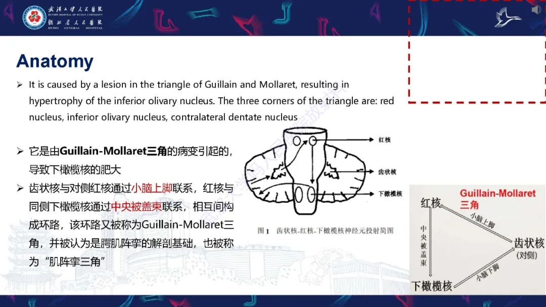 影像PPT - 【PPT】肥大性下橄榄核变性MRI诊断-5