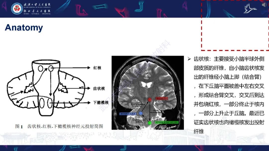 影像PPT - 【PPT】肥大性下橄榄核变性MRI诊断-7