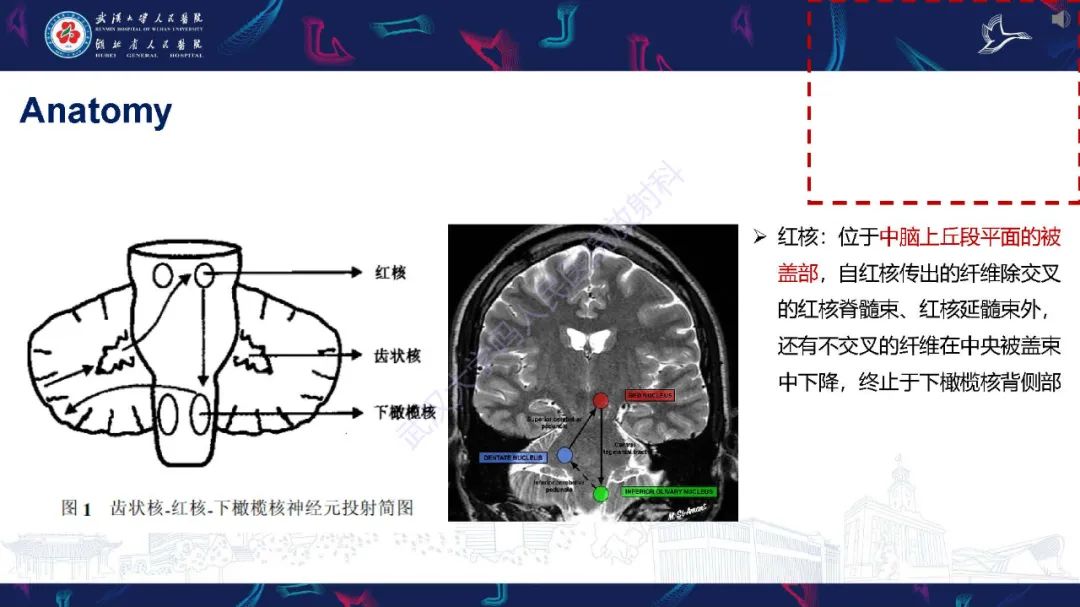 影像PPT - 【PPT】肥大性下橄榄核变性MRI诊断-8