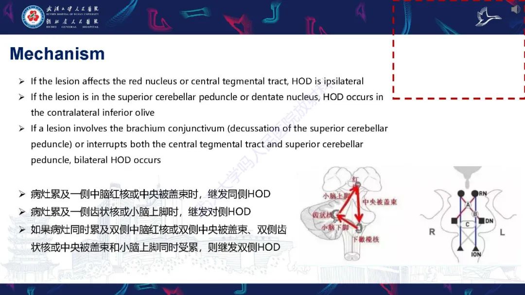 影像PPT - 【PPT】肥大性下橄榄核变性MRI诊断-9