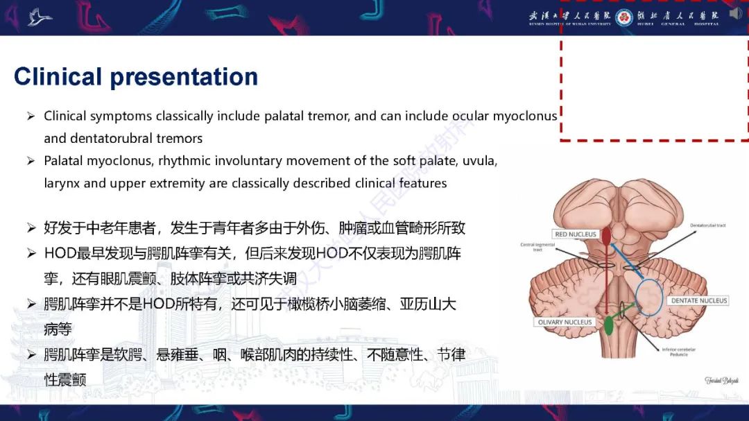 影像PPT - 【PPT】肥大性下橄榄核变性MRI诊断-11
