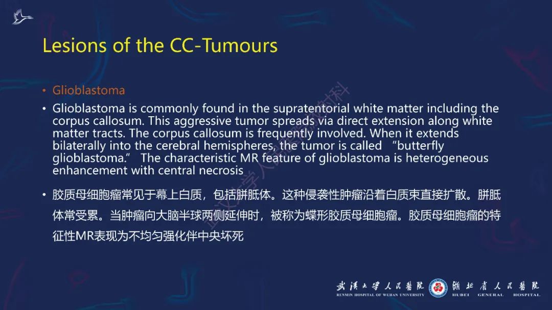 影像PPT - 【PPT】胼胝体病变影像诊断-32