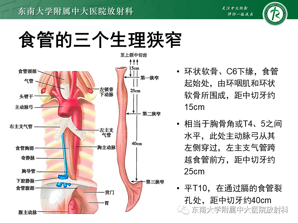 影像PPT - 【病例】食管-气管瘘1例CT影像-6