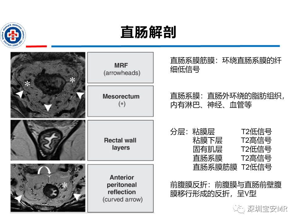 影像PPT - 【PPT】直肠癌MRI影像评估-3