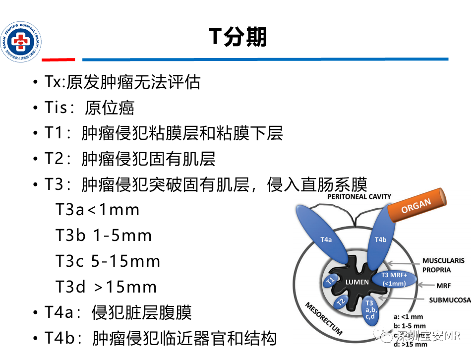 影像PPT - 【PPT】直肠癌MRI影像评估-10