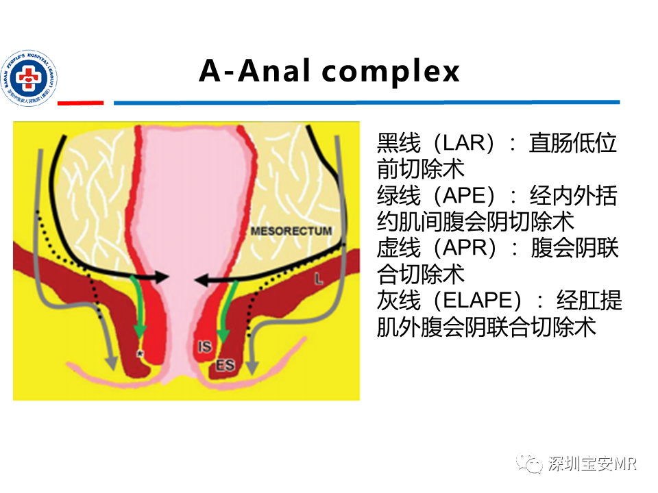影像PPT - 【PPT】直肠癌MRI影像评估-28