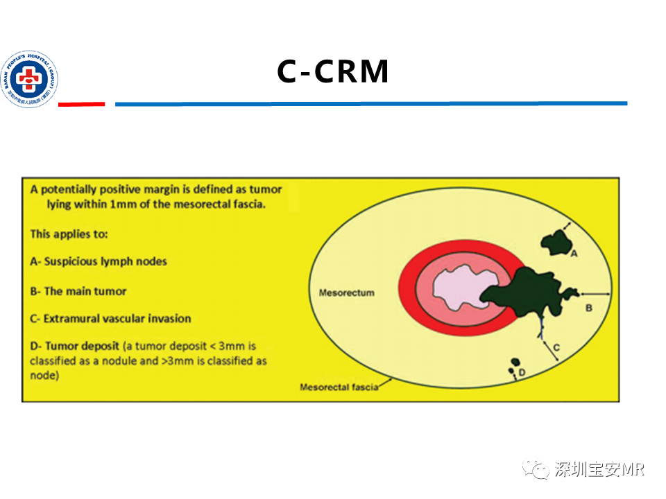影像PPT - 【PPT】直肠癌MRI影像评估-37