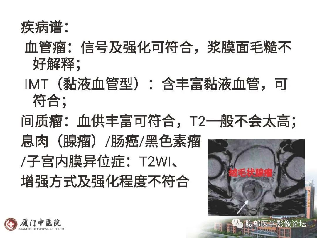 影像PPT - 【病例】直肠炎性肌纤维⺟细胞瘤1例MR影像-10 影像PPT - 【病例】直肠炎性肌纤维⺟细胞瘤1例MR影像-10