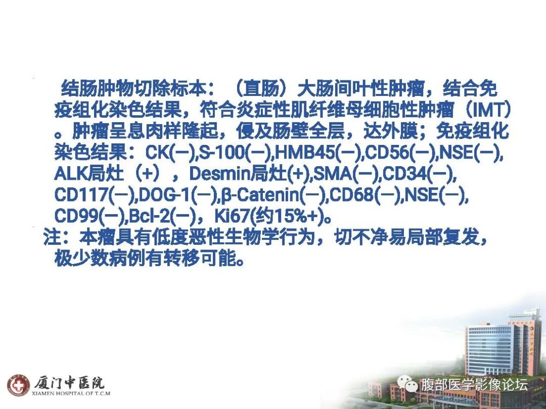 影像PPT - 【病例】直肠炎性肌纤维⺟细胞瘤1例MR影像-12 影像PPT - 【病例】直肠炎性肌纤维⺟细胞瘤1例MR影像-12